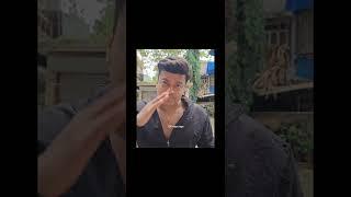For Those Morons Who Think I Wear Sunglasses Due to an Eye Problem, Watch This! #bigbongeyes