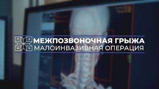 Межпозвоночная грыжа. Малоинвазивная операция