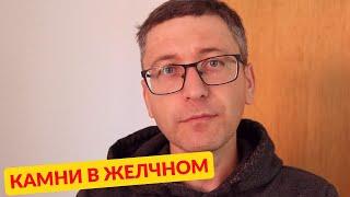 Камни в желчном пузыре, отказался от операции / Желчекаменная болезнь, чем я лечился?