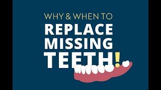 After An Extraction: Why & When to Replace Missing Teeth