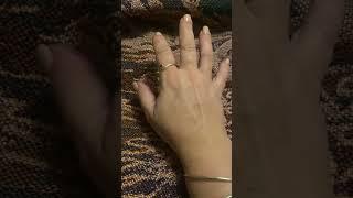 ALS Hand Spastcicity