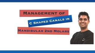 Endodontic Management of C-shape Canals