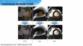 ISMRM MR Academy - Systolic Function