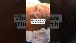 MAGICALThe Most RARE Human Birth #birth