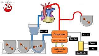 Cardiopulmonary bypass (CPB) circuit