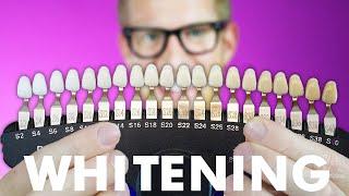 Dentist Explains Everything About Teeth Whitening: At Home Products, Toothpaste, Peroxide Bleach Kit