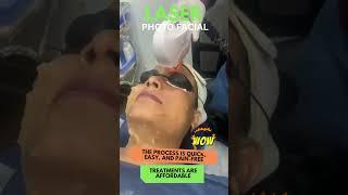 Laser photofacial | skin whitening facial at Newderma Aesthetic clinic mira road| hydrafacial mumbai