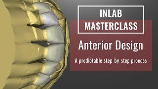 InLab 18: Anterior Design Tips & Tricks