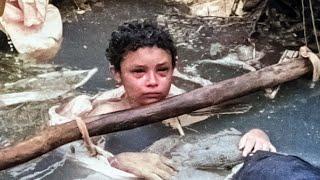 The Worlds Saddest Photograph - Omaira Sanchez