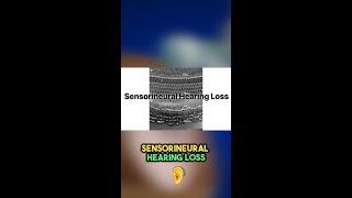 Common Causes of Permanent Hearing Loss