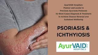 Psoriasis Treatment in Ayurveda | Apollo AyurVAID Hospitals