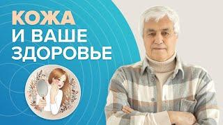 Заболевания кожи и ваше здоровье: Есть ли ВЗАИМОСВЯЗЬ | Что влияет на состояние кожи