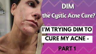 #DIM - The Cystic Acne Cure?????? One Month In