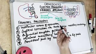 frankel appliance in orthodontics (part 1)