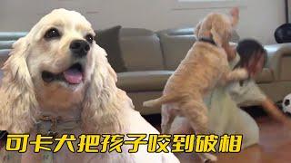 可卡犬把孩子咬到破相，爹媽卻完全不當回事，還說打打鬧鬧不就這樣？