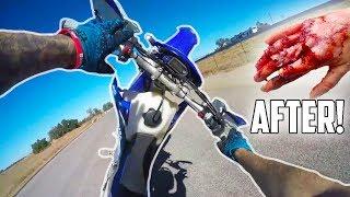 ALMOST LOST MY HAND! (Wheelie Crash Gone Bad)