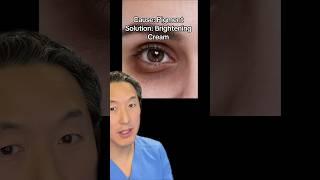 How to Get Rid of Undereye Dark Circles!