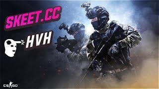 New Name HvH CSGO Highlights ft. Skeet.cc#1