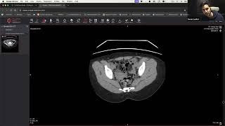 Master CT Scan of urinary track with Dr. Lasker  #radiology #ctimaging  #medicalcourse #medicaldegre