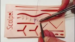 Непрерывный обвивной хирургический шов \ Continuous wraparound surgical suture