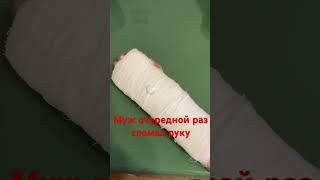 Муж сломал руку#shorts#перелом#переломруки#упалсвелосипеда#дача