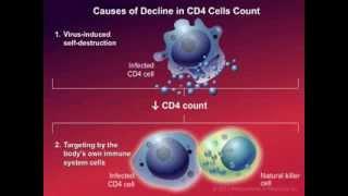 How HIV Causes Disease