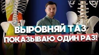 Как выровнять таз. Как определить перекос таза. Косой таз причины.