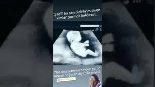 gülmek serbest 