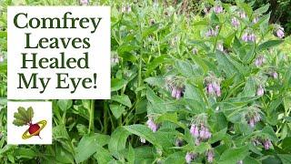 Comfrey Leaves Healed My Eye!