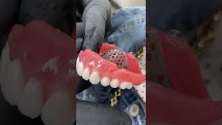 Try-In Denture