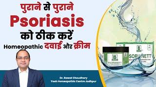 Psorianett cream for Psoriasis | सोरायसिस का इलाज | Best Psoriasis treatment in India|