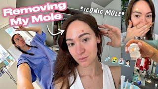 I Finally Did It... The Mole Is GONE ️