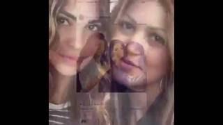 Negin Mirsalehi Before the surgery (no hate, just saying the truth)