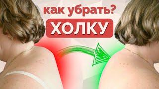 Как убрать вдовий горб? Упражнения от холки.