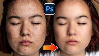 Face Retouching Best Photoshop Tricks || Skin Retouching || DK ARNIYA