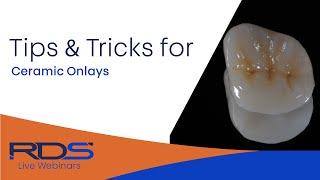 Tips and tricks Ceramic Onlays