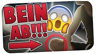 HEFTIGER UNFALL!! - FREUND VERLIERT BEIN!!! | AniBeast