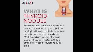 Minimal invasive treatment for thyroid nodules