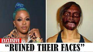 20 Black celebrities Who RUINED Their Careers With PLASTIC SURGERY