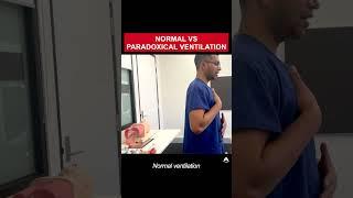 Normal vs Paradoxical Ventilation | #anesthesia #bagmaskventilation #airway