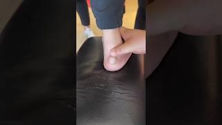 E2660 The lump on thepatient's foot was larger than an egg and very hard!