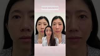 This is what we call full facial balancing  #botox #botoxfiller #medspa #beauty #filler