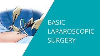 Basic Laparoscopic Surgery