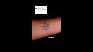 This weed leaf tattoo will DISAPPEAR in 12 months?!