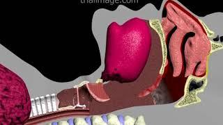 Endotracheal Intubation Animation by Cal Shipley, M.D.