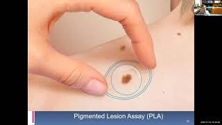 Skin Cancer Diagnosis and Misdiagnosis with Benjamin Hsu, MD