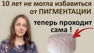 Неожиданное средство от пигментации - пробиотические продукты ежедневно.