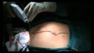 Basic Surgical Skill Series : Opening and Closing the Skin