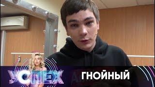 Гнойный читает о себе в сети