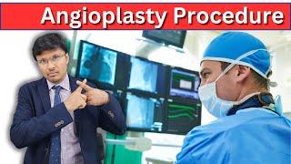 Angioplasty Procedure: Step-by-Step Guide to Unblocking Arteries